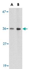 Anti-HAPLN2 Rabbit Polyclonal Antibody