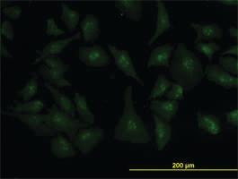 Anti-ZIC4 Mouse Monoclonal Antibody [clone: 1A9]