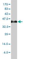 Anti-SERPINH1 Mouse Monoclonal Antibody [clone: 1D2-1A6]