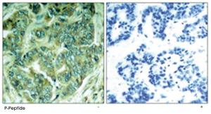 Anti-DOK1 Rabbit Polyclonal Antibody