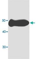 Anti-MDH1 Mouse Monoclonal Antibody [clone: 99n65]