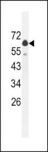 Anti-GLS2 Rabbit Polyclonal Antibody (AP (Alkaline Phosphatase))