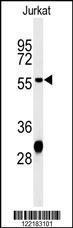 Anti-HADHB Rabbit Polyclonal Antibody (FITC (Fluorescein Isothiocyanate))