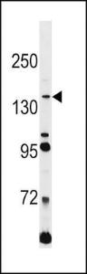 Anti-L1CAM Rabbit Polyclonal Antibody (APC (Allophycocyanin))