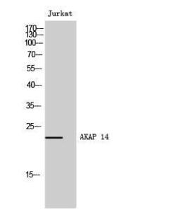 Western blot analysis of Jurkat cells using Anti-AKAP14 Antibody