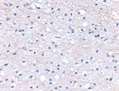 Anti-HAPLN2 Rabbit Polyclonal Antibody