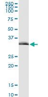 Anti-TIRAP Rabbit Polyclonal Antibody