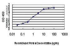 Anti-ZIC4 Mouse Monoclonal Antibody [clone: 1A9]