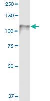 Anti-CDH3 Polyclonal Antibody Pair