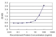 Anti-ANXA5 Antibody Pair