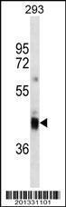 Anti-CD7 Mouse Monoclonal Antibody [clone: 366CT28.2.3]