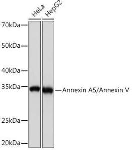 Anti-Annexin V/ANXA5 antibody