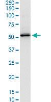 Anti-SERPINH1 Mouse Monoclonal Antibody [clone: 1D2-1A6]