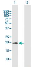 Anti-COPS8 Mouse Polyclonal Antibody