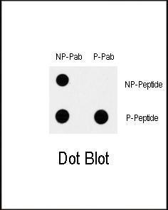 Anti-MAP3K7 Rabbit Polyclonal Antibody (HRP (Horseradish Peroxidase))