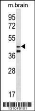 Anti-ORC5 Rabbit Polyclonal Antibody (PE (Phycoerythrin))