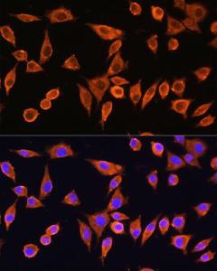 Immunofluorescence analysis of L929 cells using Anti-RPS28 Antibody (A93318) at a dilution of 1:100 DAPI was used to stain the cell nuclei (blue)