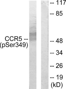 Western blot analysis of lysates from RAW264.7 cells treated with PMA 125ng/ml 30' using Anti-CCR5 (phospho Ser349) Antibody. The right hand lane represents a negative control, where the antibody is blocked by the immunising peptide