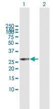 Anti-RAB27B Mouse Polyclonal Antibody