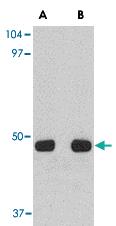 Anti-UNC93A Rabbit Polyclonal Antibody