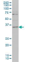 Anti-ZIC4 Mouse Monoclonal Antibody [clone: 3D5]