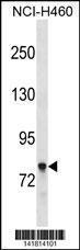 Anti-AMPH Rabbit Polyclonal Antibody (HRP (Horseradish Peroxidase))