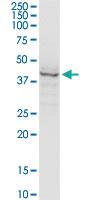 Anti-SERPINH1 Mouse Monoclonal Antibody [clone: 1D2-1A6]