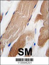 Anti-ILK Rabbit Polyclonal Antibody (Biotin)