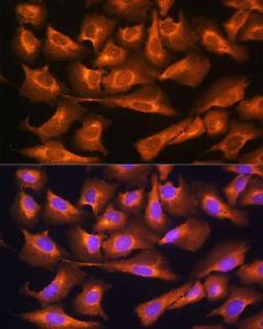 Immunofluorescence analysis of U2OS cells using Anti-RPS28 Antibody (A93318) at a dilution of 1:100 DAPI was used to stain the cell nuclei (blue)