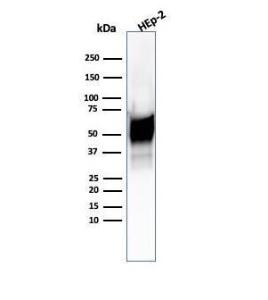 Western blot analysis of Hep2 cell lysate using Anti-HSP60 Antibody [HSPD1/6496R]