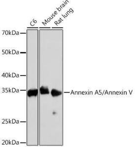 Anti-Annexin V/ANXA5 antibody