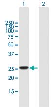 Anti-RAB27B Mouse Polyclonal Antibody