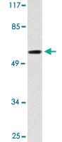 Anti-CYP7B1 Rabbit Polyclonal Antibody