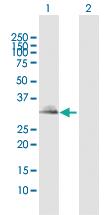 Anti-TIRAP Rabbit Polyclonal Antibody