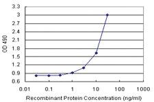 Anti-ANXA5 Polyclonal Antibody Pair