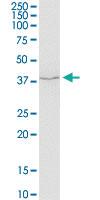 Anti-SERPINH1 Mouse Monoclonal Antibody [clone: 1D2-1A6]