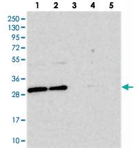 Anti-BCDIN3D Rabbit Polyclonal Antibody