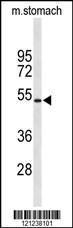 Anti-KCNJ11 Rabbit Polyclonal Antibody (AP (Alkaline Phosphatase))