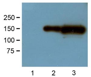 1:1000 (1 µg/mL) Ab dilution probed against HEK293 cells transfected with GFP-tagged protein vector: untransfected control (1), 1 µg (2) and 10 µg (3) of cell lysates used