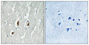 Immunohistochemical analysis of paraffin-embedded human brain tissue using Anti-SRF Antibody. The right hand panel represents a negative control, where the antibody was pre-incubated with the immunising peptide.