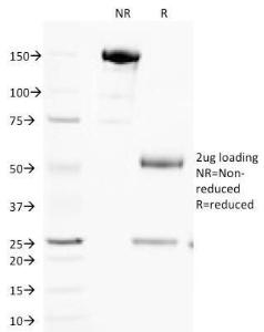 SDS-PAGE analysis of Anti-Cytochrome C Antibody [SPM389] under non-reduced and reduced conditions; showing intact IgG and intact heavy and light chains, respectively SDS-PAGE analysis confirms the integrity and purity of the antibody