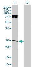 Anti-GDNF Rabbit Polyclonal Antibody