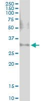 Anti-CACUL1 Rabbit Polyclonal Antibody