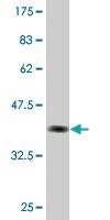 Anti-CFLAR Mouse Monoclonal Antibody [clone: 1G1]