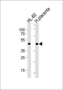 Anti-MYOD1 Rabbit Polyclonal Antibody (AP (Alkaline Phosphatase))