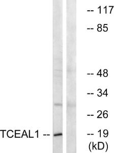 Western blot analysis of lysates from COLO cells using Anti-TCEAL1 Antibody The right hand lane represents a negative control, where the antibody is blocked by the immunising peptide