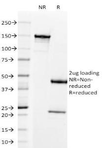 Anti-Prolactin Receptor Mouse Monoclonal Antibody [clone: B6.2]