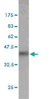 Anti-FXR1 Mouse Monoclonal Antibody [clone: 2G11]