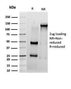 SDS-PAGE analysis of Anti-IRF3 Antibody [PCRP-IRF3-6H10] under non-reduced and reduced conditions; showing intact IgG and intact heavy and light chains, respectively SDS-PAGE analysis confirms the integrity and purity of the antibody