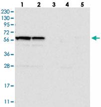 Anti-C6ORF118 Rabbit Polyclonal Antibody